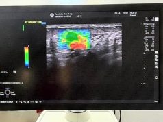 Investigații mai precise pentru pacienții OncoHelp. Un ecograf de ultimă generație, cu elastografie, a intrat în dotarea centrului