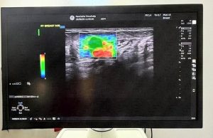 Investigații mai precise pentru pacienții OncoHelp. Un ecograf de ultimă generație, cu elastografie, a intrat în dotarea centrului